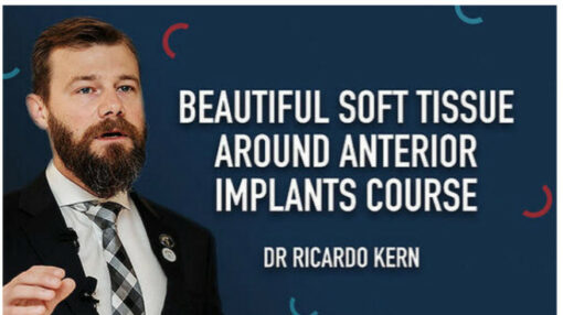 Beautiful Soft Tissue Around Anterior Implants
