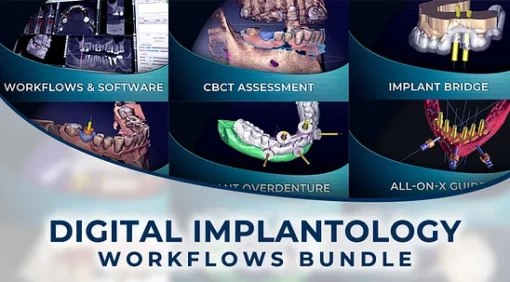 Digital Implantology Workflows Bundle ( 6 COURSES )