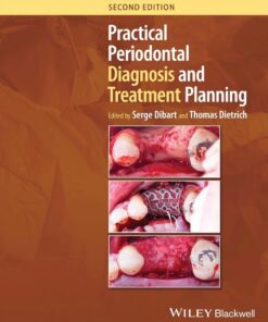 Practical Periodontal Diagnosis and Treatment Planning 2e 2024