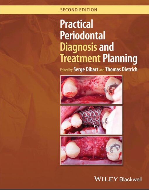 Practical Periodontal Diagnosis and Treatment Planning 2e 2024