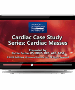Cardiac Case Study Series: Cardiac Masses