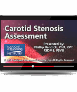 Carotid Stenosis Assessment