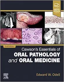 Cawson’s Essentials Of Oral Pathology And Oral Medicine, 10th Edition (EPub+Converted PDF)