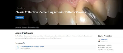 Classic Collection: Cementing Anterior Esthetic Crowns