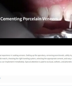 Classic Collection: Cementing Porcelain Veneers