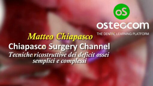 Chiapasco Surgery Channel - Matteo Chiapasco Tecniche ricostruttive dei deficit ossei semplici e complessi