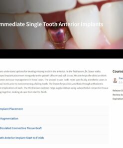 Classic Collection: Immediate Single Tooth Anterior Implants