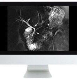 Clinical Abdominal Imaging Review