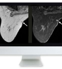 Clinical Breast Imaging Review