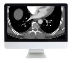 Clinical Cardiopulmonary Imaging Review