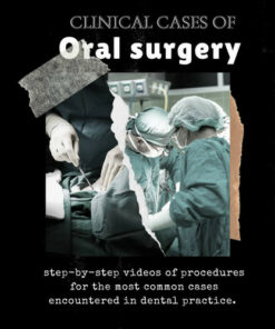 Clinical Cases of Oral Surgery