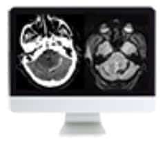 Clinical Neuroradiology Review