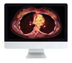 Clinical Nuclear Medicine Review