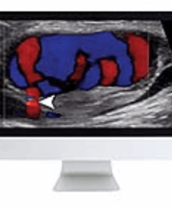 Clinical Ultrasound Review