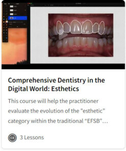 Comprehensive Dentistry in the Digital World: Esthetics