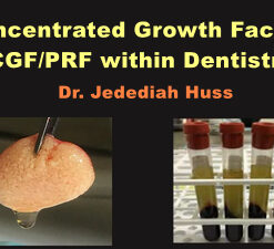 Concentrated Growth Factors: CGF/PRF within Dentistry (Video)