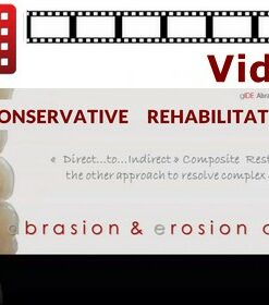 Color and Restorative Dentistry: Direct Composite Restorations