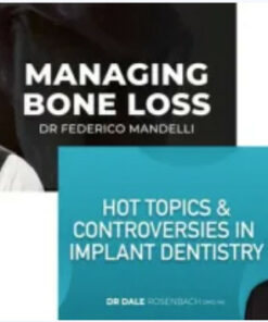 Controversies in Implant Dentistry and Managing Bone Loss