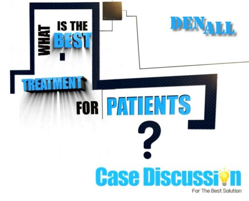 DENALL What is the Best Treatment for Patients? Case Discussion Korean with English Narration