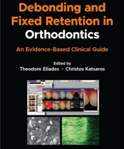 Debonding and Fixed Retention in Orthodontics: An Evidence-Based Clinical Guide original PDF  
