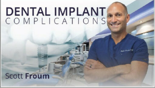Dental Implant Complications (Video Course)