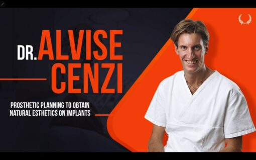 DentalLeaders Prosthodontic Planning to Obtain Natural Esthetic on Implants - Alvise Cenzi