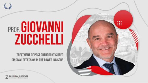 DentalLeaders Treatment of Post Orthodontic Deep Gingival Recession in the Lower Incisors - Giovanni Zucchelli