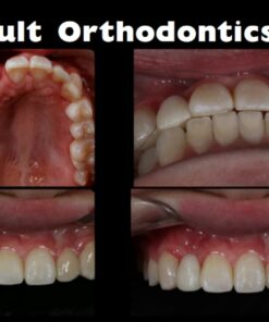 DentalXP Adult Orthodontics
