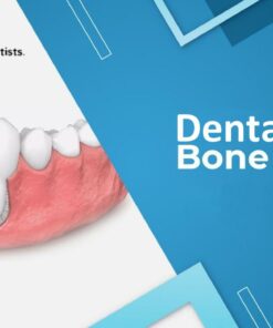 DentalXP Bone Grafts