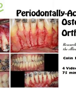 DentalXP Periodontally-Accelerated Osteogenic Orthodontics / Colin Richman