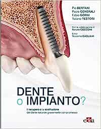 Dente o impianto? Il recupero e la sostituzione del dente naturale gravemente compromesso EPUB