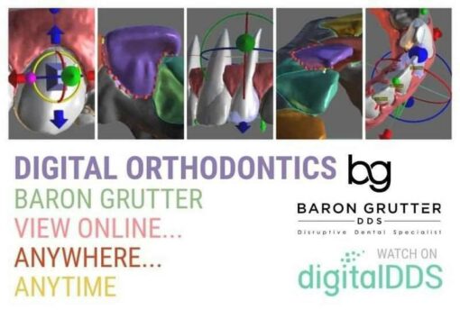 Digital Orthodontics Online Course (Clear Aligners) - Baron Grutter