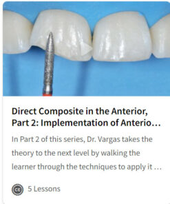Direct Composite in the Anterior, Part 2: Implementation of Anterior Composites