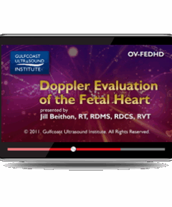Doppler Evaluation of the Fetal Heart