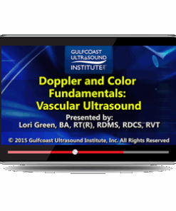 Doppler and Color Fundamentals: Vascular Ultrasound
