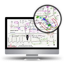ECG Academy: Advanced Level Video Lecture Course-Videos