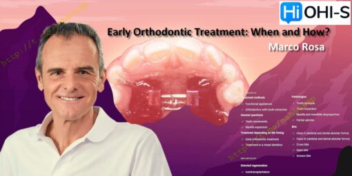 Early orthodontic treatment: when and how?