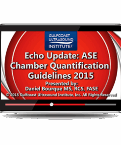 Echo Update: ASE Chamber Quantification Guidelines