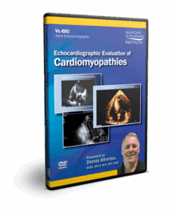 Echocardiographic Evaluation of Cardiomyopathies