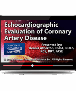Echocardiographic Evaluation of Coronary Artery Disease