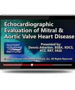 Echocardiographic Evaluation of Mitral and Aortic Valve Heart Disease