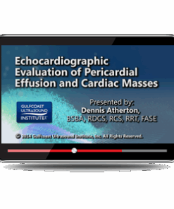 Echocardiographic Evaluation of Pericardial Effusions and Cardiac Masses