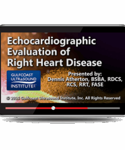 Echocardiographic Evaluation of Right Heart Disease