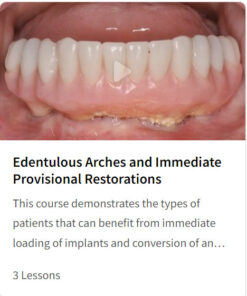 Edentulous Arches and Immediate Provisional Restorations