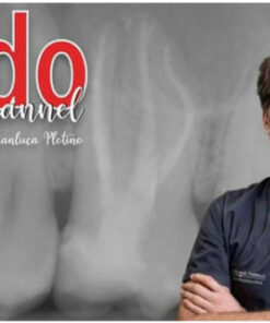 Endo Channel: The Excellence in Endodontic Treatment Made Easy