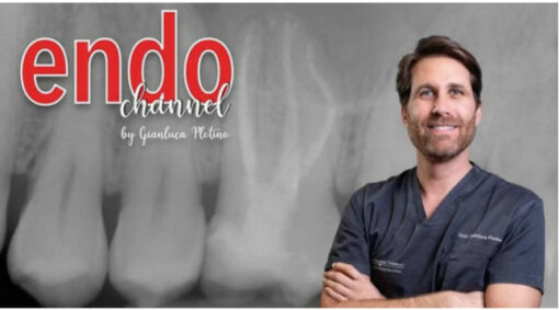 Endo Channel: The Excellence in Endodontic Treatment Made Easy