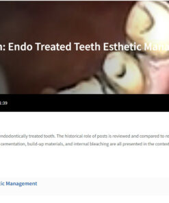Classic Collection: Endo Treated Teeth Esthetic Management