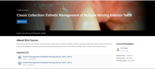 Classic Collection: Esthetic Management of Multiple Missing Anterior Teeth