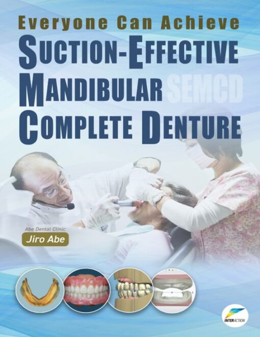 Everyone Can Achieve SUCTION-EFFECTIVE MANDIBULAR COMPLETE DENTURE PDF 