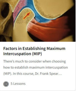 Factors in Establishing Maximum Intercuspation (MIP)
